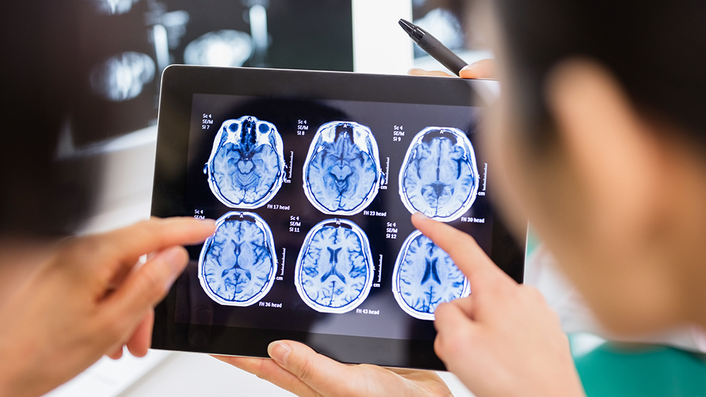 Los médicos observan una imagen de RM del cerebro