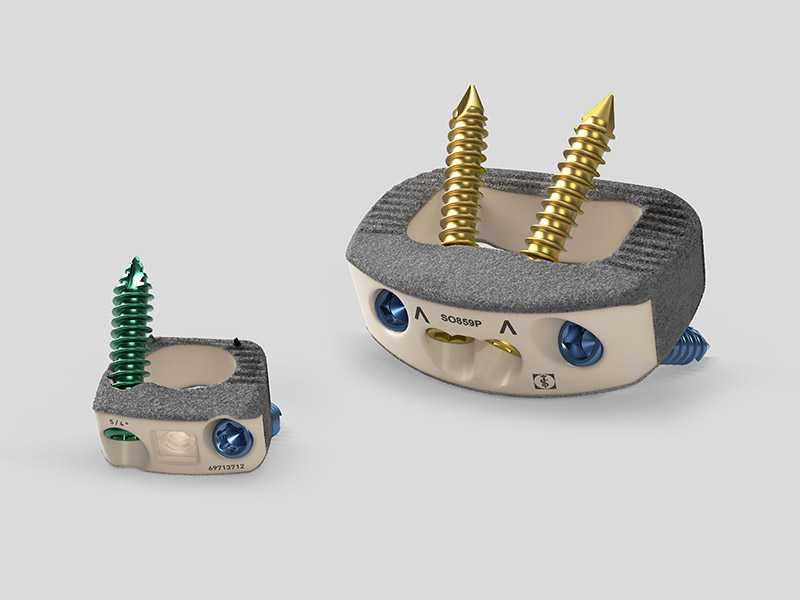 Implantes de fusión intersomática recubiertos con Plasmapore XP.